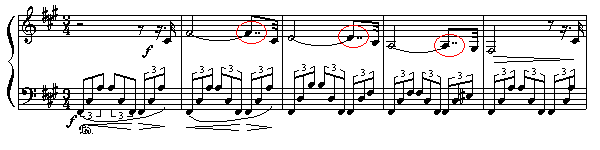 Kraviersonate Nr. 1, Op.11 (5K)