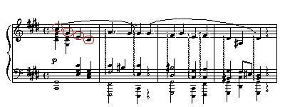 Symphonische Et&uumlden VaThema (4 K)